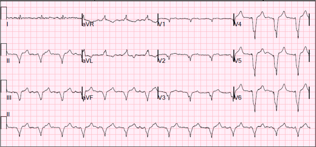 Screen Shot 2015-04-16 at 9.34.09 AM