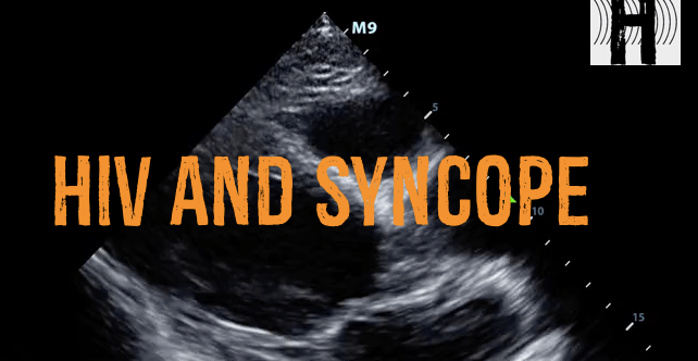 HIV and Syncope